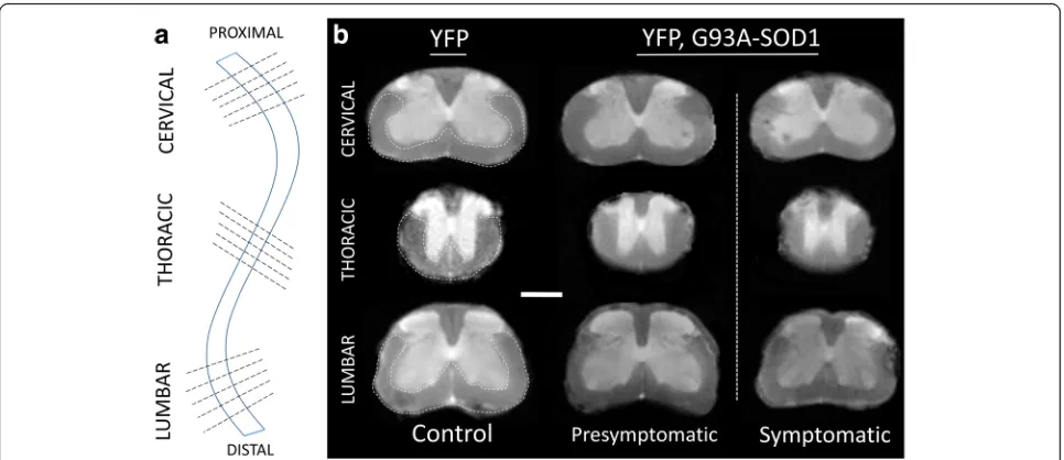 Fig. 1 Ex vivo analysis of presymptomatic spinal cord of ALS mice by Ultra-High Field MRI diffusion