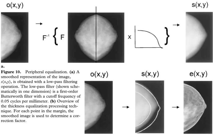 Figure 10. Peripheral equalization. (a) A smoothed representation of the image, s(x,y), is obtained with a low-pass filtering operation