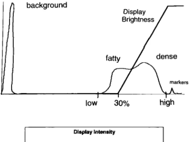 Figure 5. Histogram for a digital mammogram. The range of intensity values representing breast tissue is seen on the right