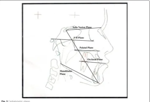 Fig. 3 Cephalometric planes