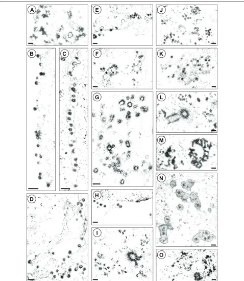 Figure 4 Ultrastructural analysis of particle morphogenesis of proviruses expressing different Gag-Pol fusion proteins