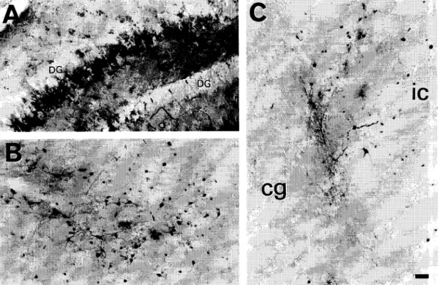 Fig.  3.  The  expression  of  fl-galactosidase  3  weeks  after  the  infusion  of  1  /xl of  AAV-lacZ  vectors  (5 X  1 0  4  panicles//xl)  into  the  hippocampus  (A)  or  inferior  colliculus  (B)  of  the  4-day-old  rat