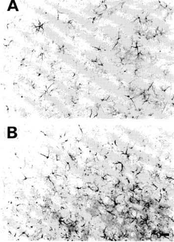 Fig. 6.  GFAP immunoreactivity in sections from the inferior colliculus 3  months aflcr thc  injection of  1  /zl  AAV-lacZ  (5 × 104  particles/#1)
