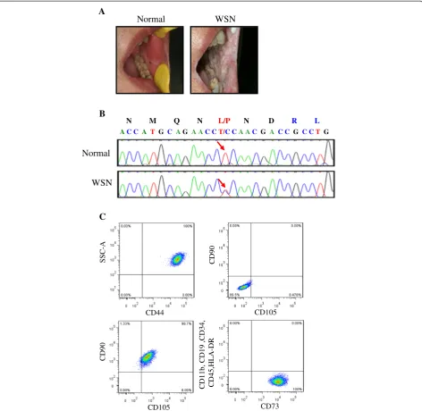 Fig. 1 Mutation analysis and establishment of cell lines. a: White spongy oral plaques in the buccal mucosa of the normal subjects and the WSNpatients; b: Partial DNA sequences of exon 1A of the KRT13 gene from a Chinese family