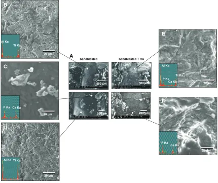 Figure 8 Morphological and elemental analyses of the sandblasted and sandblasted + hydroxyapatite-coated implant interfaces at late healing stage of week four by scanning electron microscopy and energy dispersive X-ray