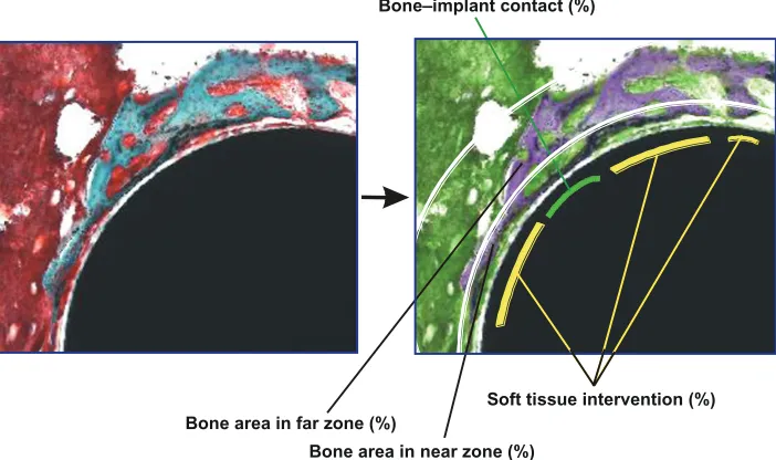 Figure 1 Description of histomorphometric analysis and parameters. Cross-sectional histological images were color converted to facilitate the discrimination of tissue types (from left to right images)