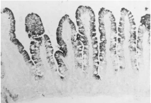 Fig. 1. Localization of CYP3A in human small bowel mucosa. Full thickness specimens of proximal jejunum were obtained from a human organ donor, formalin fixed, and reacted with a polyclonal antibody that recognizes CYP3A4