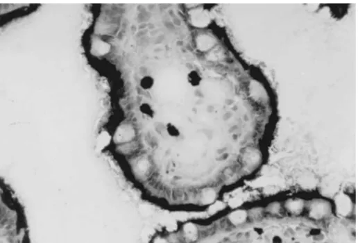 Fig. 2. Localization of P-glycoprotein in a human small bowel villus tip. The above tissue was frozen without formalin fixation (accounting for the poorer histology compared with Fig
