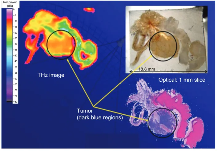 Figure 7 Prostate section with tumor tissue as imaged with terahertz, optical, and staining techniques.