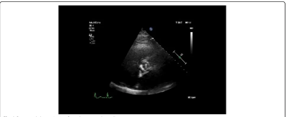Fig. 2 Parasternal short-axis view from the same echocardiogram