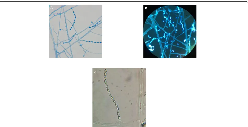 Fig. 3 Microscopic morphology of A. levis (a) lactate phenol-cotton orchid staining (× 1000)