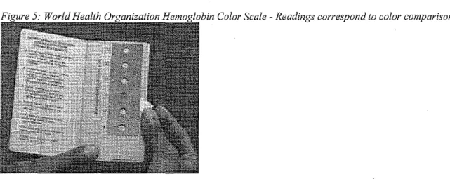 Figure  7:  Representation of a capillary tube after it has been spun.  The  red layer corresponds to  the red blood cells and the gray layer 