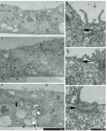 Figure 4 TEM imaging of BeWo cells grown on PC membranes with 3 µm pore size. (A and B) day 3 PS; (C and D) day 4 PS; (E and F) day 5 PS.Notes: Arrows indicate tight junctions