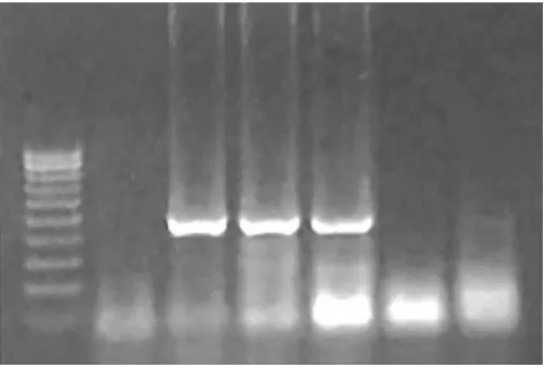 Figure 1devR Genei (India), Lane 1; Negative control, Lane 2; (on first admission), Lane 4; Patient's isolate of MDR scrofulaceumThe PCR amplified product for gene (513 bps) of M
