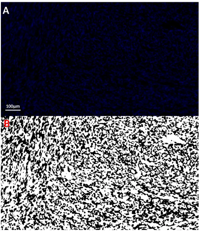 Figure S3: Fraction of Volume Populated by Cell Nuclei:  A) 10x magnification image of DAPI-stained  nuclei in an area in section 171; B) Binary representation of nuclear distribution used to quantify  nuclear density