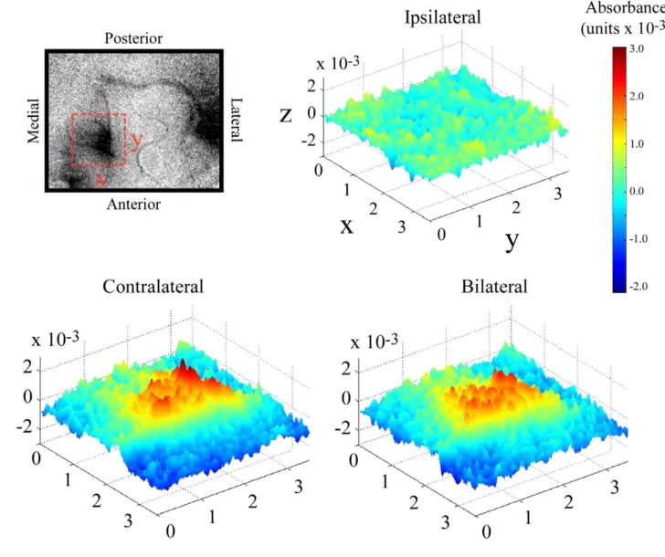 Figure 3 enables one to directly compare the temporal sequence of the SI response to contralateral, ipsilateral, and bilateral central pad flutter