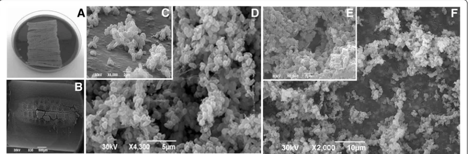Fig. 3 Biofilm formation (48 h incubation) on the surface of in vitro infected polyurethane and silicone catheters by the two C