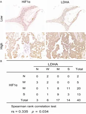 Figure 2. Correlation between HIF-1α and LDHA. A. IHC analysis showed representative low (up) and high (down) expression of HIF-1α and LDHA in consecutive sections; images were captured at × 200 magnification