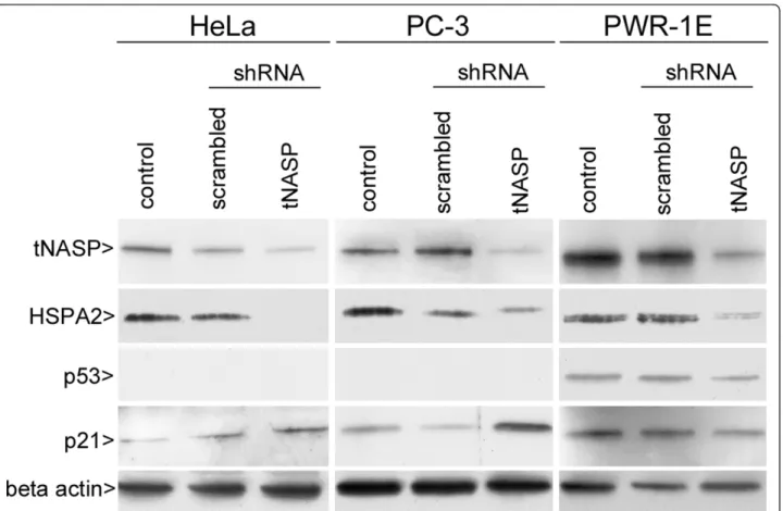 Figure 2 Western blot analysis of cell lysates after tNASP shRNA treatment demonstrating changes in protein expression in HeLa, PC- PC-3, and PWR-1E cells 6 days after treatment