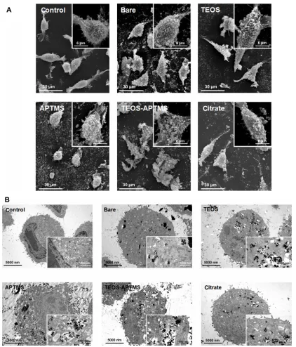 Figure 5 electron microscopy images of L-929 cells. Morphological alterations and intracellular ultrastructures of L-929 cells exposed to 500 ppm of sPIONs coated with various functional groups for 24 hours were observed by seM (Notes:1000 nm, respectively