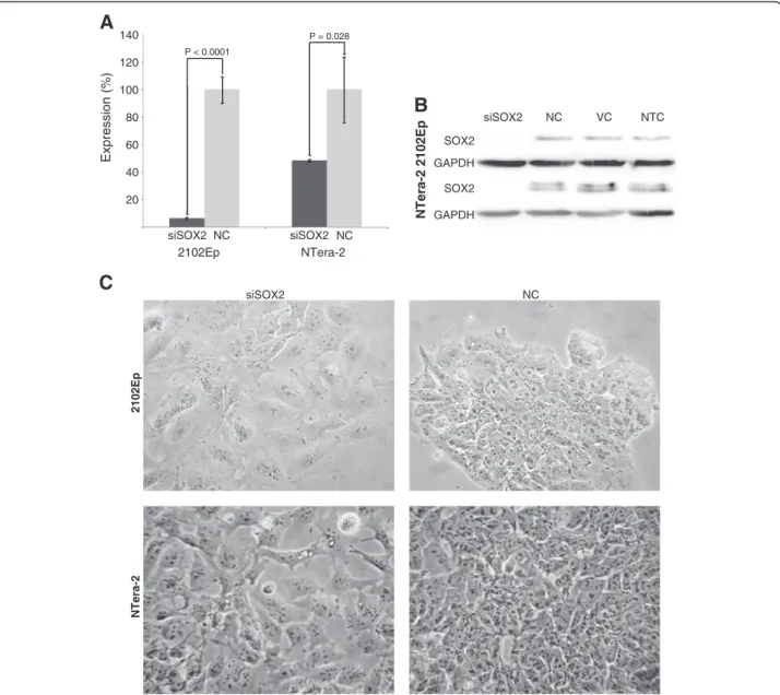 Figure 1 Knock-down of SOX2 in 2102Ep and NTera-2 cells. The induced RNAi of SOX2 mRNA by SOX2 siRNA (siSOX2) facilitated a substantial and significant down-regulation of this gene ’s expression in the EC cell lines