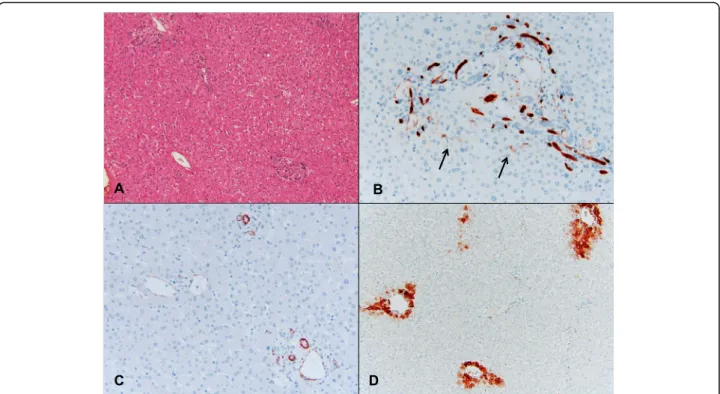 Fig. 1 An example of a control group (case 29 in Table 5) in which a patient with CLRM did not receive chemotherapy prior to resection