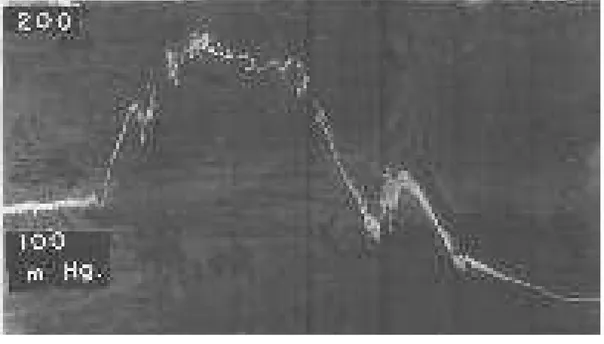 Figure 3: Pathophysiology in scorpion envenoming syndrome and its reversal by administration of insulin