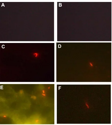 Figure 5 Schematic illustration for detecting Mycobacterium tuberculosis based on fluorescent silica nanoparticle assay.