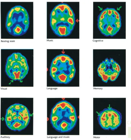 FIGURE 1.1  PET scans show the brain activity of normal people engaged in different activities