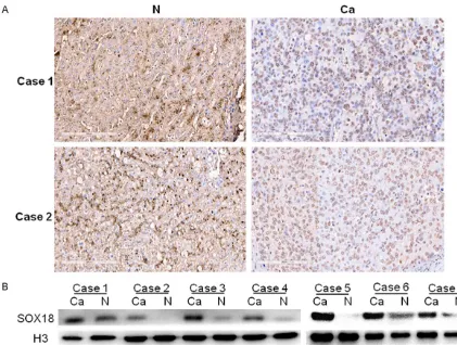 Table 1. SOX18 expression in HCC cells and non-tumor liver cells