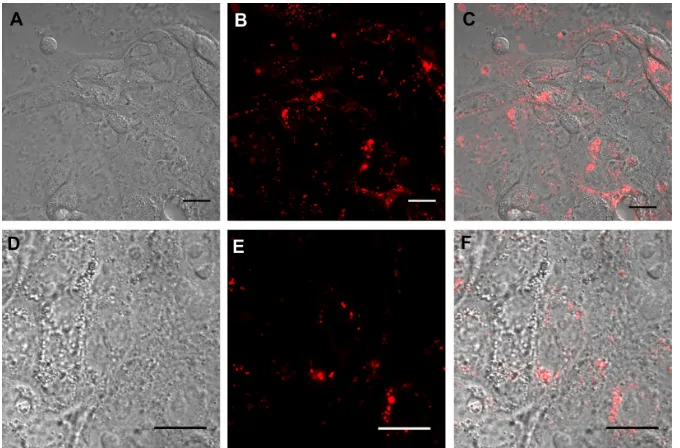 Figure S2 real time confocal laser scanner microscopy images of calu-3 cells exposed to rhod-PLgA/cs nanoparticles for 24 hours and subsequent washing of the medium