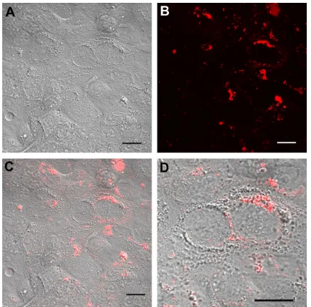 Figure 5 real time confocal laser scanner microscopy images of calu-3 cells exposed Nomarski and fluorescence images, and (Note: Abbreviations: to rhod-PLgA/PVA nanoparticles for 24 hours and subsequent washing of the medium