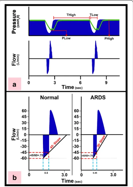 Fig. 6 aexpiratory duration necessary to stabilize the lung. The SEFC of thenormal lung is approximately 45°, which decreases to 30° in acuterespiratory distress syndrome (ARDS)