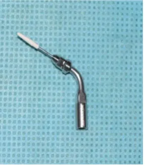 Figure 2: Group II – Carbon Composite Tip (Satelec) 