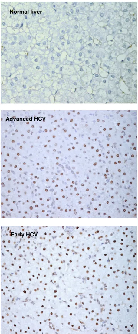Figure 2Expression of CDK inhibitor p15Expression of CDK inhibitor p15. Immunohistochemistry of p15 in normal liver and chronic HCV-infected liver with Early and Advanced HCV
