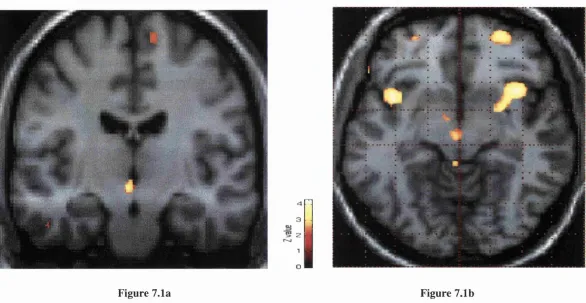 Figure 7.1aFigure 7.1b