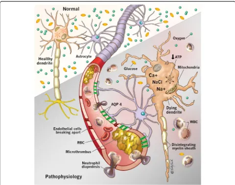 Fig. 1 A schematic demonstrating the various microvascular and cellular pathophysiologic consequences which occur during the primary andsecondary injury in hypoxic ischemic brain injury (HIBI)