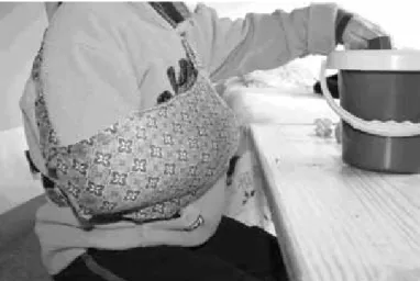 Figure 2: Restraint of the less affected right upper extremity during CIMT