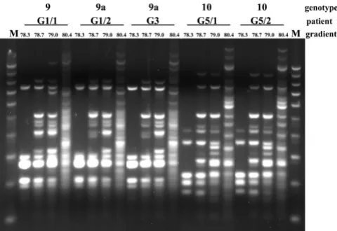 Figure 5tion temperatures in PCRPCR MP fingerprints of the C. albicans at increasing denatura-PCR MP fingerprints of the C