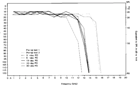Fig 2: High-frequency  threshold changes over time 
