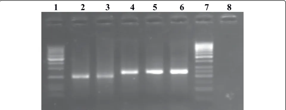 Figure 2 Typical agarose gel electrophoresis patterns of PCR products from two different HCV genotypes