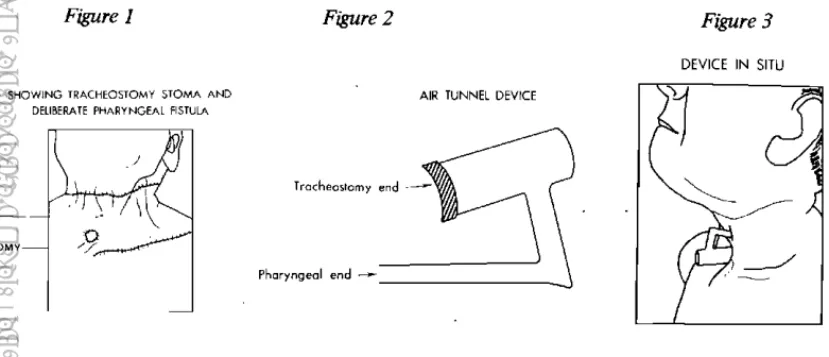 Figure  1  Figure  2 