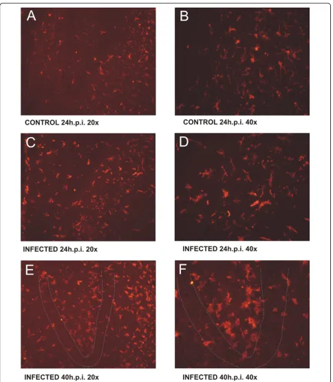 Figure 8 Histomorphometry of microglia response. The picture sequence demonstrates the morphological and spatial changes of microgliain response to experimental bacterial meningitis due to infection with S .pneumoniae
