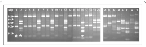 Figure 1 Representative PCR-RFLP profiles of the URA5 gene of 20 Cryptococcus isolates and 8 control strains A - H