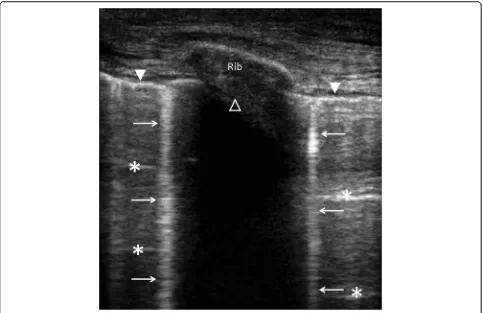 Fig. 1 Longitudinal view of an intercostal space using chest ultrasonography disclosing the pleural line (closed white arrow head), A-lines (whiteasterisks), B-lines (white arrows), and shadowing related to the rib (open white arrow head)