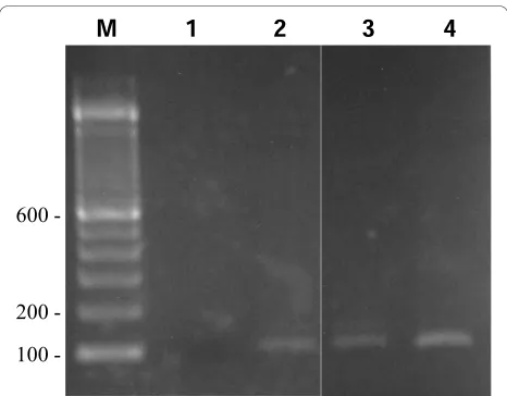 Figure 1 Agarose gel showing amplification of a DNAfragment of ~106 bp by seminested PCR with DNA isolatedfrom serum from patient 1 (lane 2) and patient 2 (lane 3)