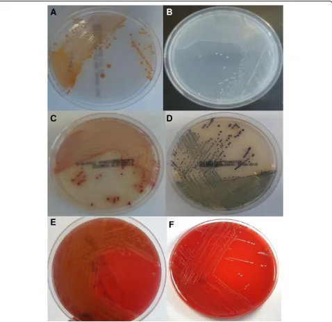 Figure 1 Appearance after 24 h incubation of (A): Streptococcus agalactiae (Group B Streptococcus (GBS) and (B) Enterococcus faecalison GBSDA, (C) GBS and (D) Enterococcus faecalis on Strepto B ID® chromogenic agar and (E) GBS and (F) Enterococcus faecalis on CNA.