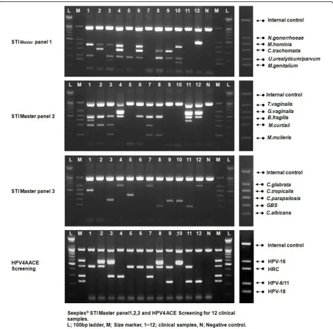 Figure 1 Sexually transmitted infection and human papillomavirus (HPV) multiplex PCR. Representative data of multiplex PCR with fourmultiplex primer mixes: Seeplex® STI Master Panel 1 (MP1), 2 (MP2), 3 (MP3) and HPV4A ACE Screening