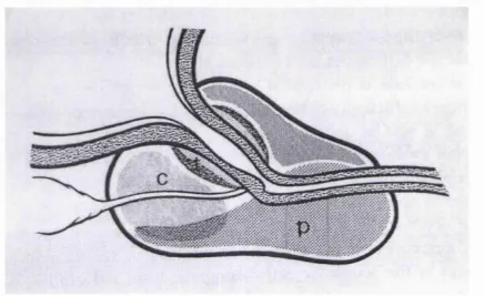 Figure 1.1: Zonal anatomy of the prostate.