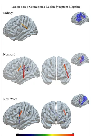 Figure 3.3. Connectome Maps. Maps indicating significant right and left hemisphere connections for each behavioral variable